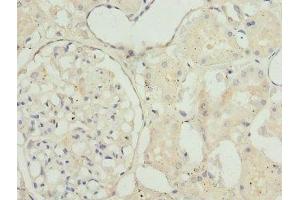Immunohistochemistry of paraffin-embedded human kidney tissue using ABIN7172851 at dilution of 1:100