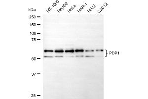 Western blotting analysis using PDP1 antibody (ABIN7800084).