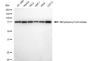 Western blotting analysis using Methylmalonyl-CoA mutase antibody (ABIN7799396). (Recombinant MUT anticorps)