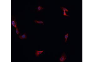 ABIN6266814 staining A549 cells by IF/ICC. (LRAT anticorps  (Internal Region))