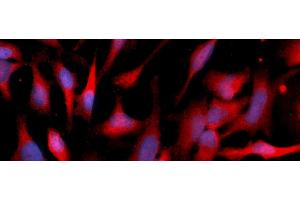 Immunofluorescence (IF) image for anti-Eukaryotic Translation Initiation Factor 5A (EIF5A) (AA 1-154) antibody (PE) (ABIN5567718)
