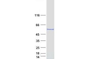 Validation with Western Blot