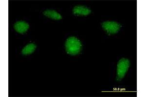 Immunofluorescence of purified MaxPab antibody to HSPC142 on HeLa cell.