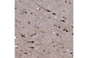 Immunohistochemical staining of human cerebral cortex with PHF8 polyclonal antibody  shows strong nuclear and cytoplasmic positivity in neuronal cells. (PHF8 anticorps)