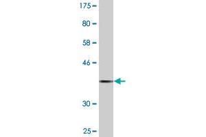 Western Blot detection against Immunogen (37.