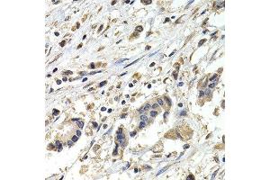 Immunohistochemistry (IHC) image for anti-Budding Uninhibited By Benzimidazoles 1 Homolog beta (Yeast) (BUB1B) (AA 1-260) antibody (ABIN3022524)