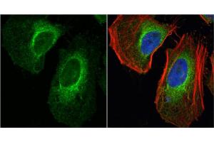 ICC/IF Image LDHA antibody detects LDHA protein at cytoplasm by immunofluorescent analysis.