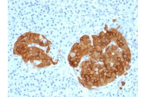 Formalin-fixed, paraffin-embedded human Pancreas stained with GAD2 (GAD65) Mouse Monoclonal Antibody (GAD2/1960). (GAD65 anticorps  (AA 6-99))