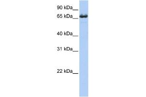 WB Suggested Anti-ZDHHC17 Antibody Titration:  0.