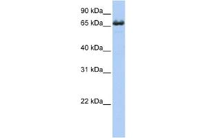 WB Suggested Anti-ZDHHC17 Antibody Titration:  0. (ZDHHC17 anticorps  (Middle Region))