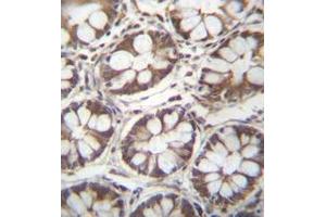 anti-Ladinin 1 (LAD1) (AA 150-180), (N-Term) antibody