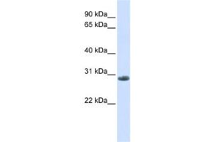 Western Blotting (WB) image for anti-Yip1 Domain Family, Member 6 (YIPF6) antibody (ABIN2458683) (YIPF6 anticorps)