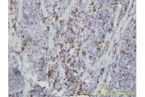 Image no. 1 for anti-Ankyrin Repeat and SOCS Box Containing 9 (ASB9) (AA 1-253) antibody (ABIN466270) (ASB9 anticorps  (AA 1-253))
