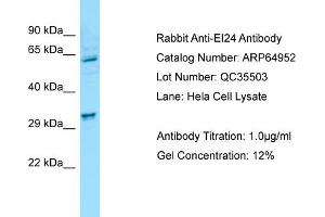 Western Blotting (WB) image for anti-Etoposide Induced 2.4 (EI24) (N-Term) antibody (ABIN970601) (EI24 anticorps  (N-Term))