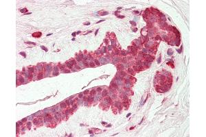 Human Breast: Formalin-Fixed, Paraffin-Embedded (FFPE) (AMIGO2 anticorps  (C-Term))