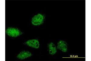 Immunofluorescence of purified MaxPab antibody to SERTAD2 on HeLa cell.