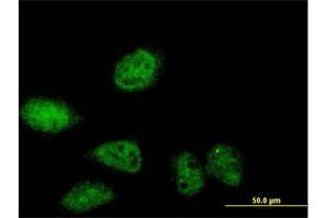 Immunofluorescence of purified MaxPab antibody to SERTAD2 on HeLa cell. (SERTAD2 anticorps  (AA 1-314))