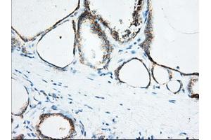 Immunohistochemical staining of paraffin-embedded Human Kidney tissue using anti-KHK mouse monoclonal antibody. (Ketohexokinase anticorps)