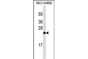 UCHL1 Antibody (ABIN1539817 and ABIN2843804) western blot analysis in NCI- cell line lysates (35 μg/lane). (UCHL1 anticorps)
