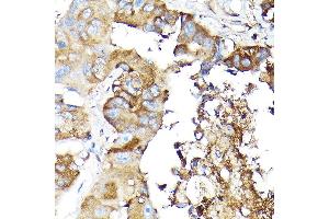 Immunohistochemistry of paraffin-embedded mouse testis using NLRP1 Rabbit pAb (ABIN7268935) at dilution of 1:100 (40x lens).