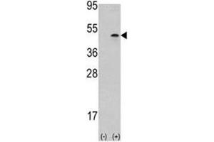 Western blot analysis of Aurora B antibody and 293 cell lysate (2 ug/lane) either nontransfected (Lane 1) or transiently transfected with the AURKB gene (2).