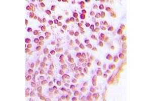 Immunohistochemistry (IHC) image for anti-Sirtuin 1 (SIRT1) antibody (ABIN7308334) (SIRT1 anticorps)
