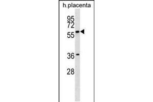 Western blot analysis in human placenta tissue lysates (35ug/lane). (GAB3 anticorps  (N-Term))