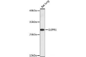 Western blot analysis of extracts of Rat lung using GLIPR1 Polyclonal Antibody at dilution of 1:1000. (GLIPR1 anticorps)
