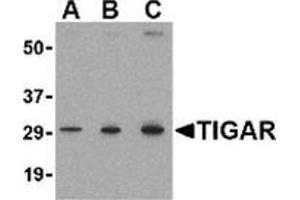 Western blot analysis of TIGAR in MCF7 cell lysate with this product at (A) 0. (TIGAR anticorps  (Center))