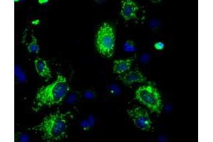 Image no. 2 for anti-ATP Synthase, H+ Transporting, Mitochondrial F1 Complex, beta Polypeptide (ATP5B) antibody (ABIN1496769)