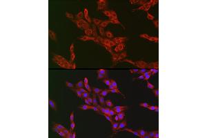 Immunofluorescence analysis of PC-12 cells using  Rabbit pAb (ABIN7265789) at dilution of 1:50 (40x lens).