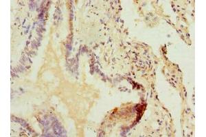 Immunohistochemistry of paraffin-embedded human lung tissue using ABIN7162554 at dilution of 1:100 (ZDHHC5 anticorps  (AA 231-500))