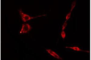 ABIN6274749 staining Hela cells by IF/ICC. (RPS15 anticorps  (C-Term))