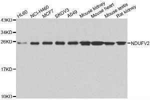 Western blot analysis of extracts of various cell lines, using NDUFV2 antibody. (NDUFV2 anticorps  (AA 1-249))