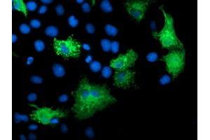 Anti-KATNB1 mouse monoclonal antibody (ABIN2455185) immunofluorescent staining of COS7 cells transiently transfected by pCMV6-ENTRY KATNB1 (RC201852). (KATNB1 anticorps)