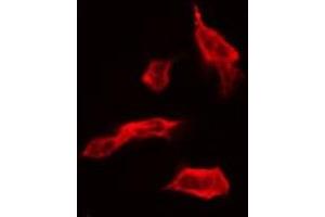 ABIN6267682 staining HT29 by IF/ICC.