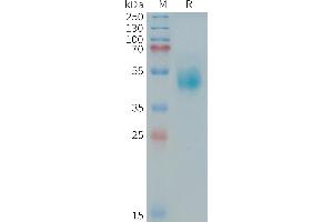 Human (544-643) Protein, hFc Tag on SDS-PAGE under reducing condition.