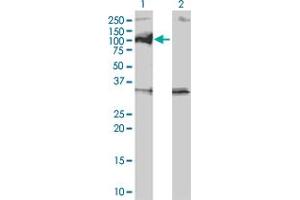 Western Blot analysis of PPM1D expression in transfected 293T cell line by PPM1D monoclonal antibody (M01), clone 4D1. (PPM1D anticorps  (AA 496-605))