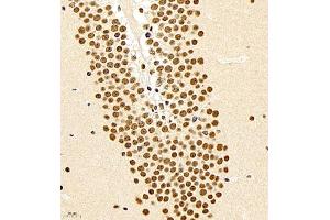 Immunohistochemistry of paraffin embedded mouse brain using smad62024 (ABIN7075629) at dilution of 1:1000 (400x lens)