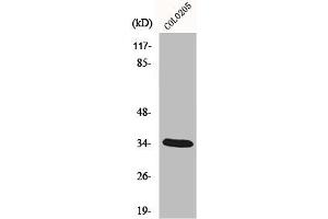 Western Blot analysis of COLO205 cells using MOX-2 Polyclonal Antibody (MEOX2 anticorps  (Internal Region))