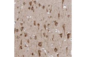 Immunohistochemical staining of human hippocampus with AADACL1 polyclonal antibody  shows strong cytoplasmic positivity in neuronal cells. (NCEH1 anticorps)