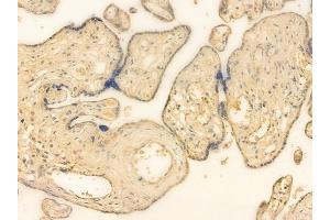 ABIN6262161 and ABIN6266557 at 1/100 staining human normal placenta tissue by IHC-P. (HCG beta anticorps  (Internal Region))