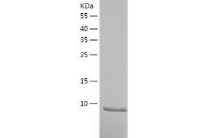 Western Blotting (WB) image for Secretoglobin, Family 1D, Member 1 (SCGB1D1) (AA 22-90) protein (His-IF2DI Tag) (ABIN7125004) (SCGB1D1 Protein (AA 22-90) (His-IF2DI Tag))