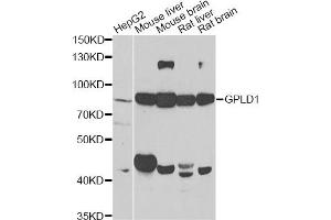 Western blot analysis of extracts of various cell lines, using GPLD1 antibody (ABIN2562895) at 1:1000 dilution. (GPLD1 anticorps)