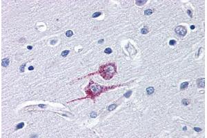 Human Brain, Cortex (formalin-fixed, paraffin-embedded) stained with TRIM25 antibody ABIN343907 at 10 ug/ml followed by biotinylated goat anti-rabbit IgG secondary antibody ABIN481713, alkaline phosphatase-streptavidin and chromogen.