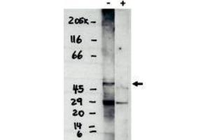 Image no. 1 for anti-Sphingosine-1-Phosphate Receptor 4 (S1PR4) (C-Term) antibody (ABIN201606) (S1PR4 anticorps  (C-Term))