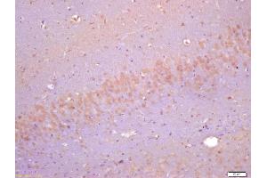 Formalin-fixed and paraffin embedded rat brain labeled with Anti-Cyclin F Polyclonal Antibody, Unconjugated (ABIN732968) at 1:200 followed by conjugation to the secondary antibody and DAB staining
