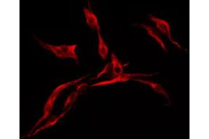 ABIN6272349 staining HuvEc by IF/ICC.