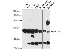 Western blot analysis of extracts of various cell lines, using  antibody (ABIN6127385, ABIN6137296, ABIN6137297 and ABIN6216941) at 1:3000 dilution. (ATP13A2 anticorps  (AA 67-210))
