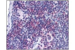 Image no. 1 for anti-T-Cell Immunoglobulin and Mucin Domain Containing 4 (TIMD4) (Center) antibody (ABIN302874) (TIMD4 anticorps  (Center))